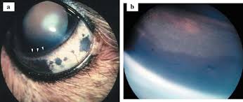 Image result for melanosis sclera
