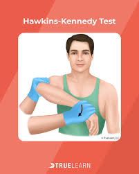 Image result for Hawkins Test