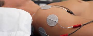 Image result for Electrical Stimulation Therapy