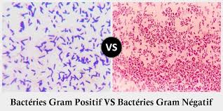La comparaison cours et exercices. La Difference Entre Bacteries Gram Positif Et Bacteries Gram Negatif Ma Biologie