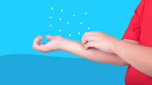 Ringworm is caused by a worm probably the most pervasive ringworm myth, this one stems from the. Ringworm In Kids The Parent S Guide To Symptoms And Treatment