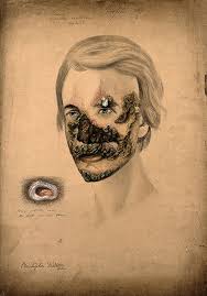 The Sick Rose Disease And The Art Of Medical Illustration Are Photographs Of Eradicated Diseases And Antiquated Treatments History Or Just Horror With Images Medical Illustration Vintage Medical Antique Illustration