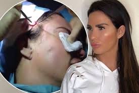 Check spelling or type a new query. Katie Price Plastic Surgery 2018 Before And After Photos