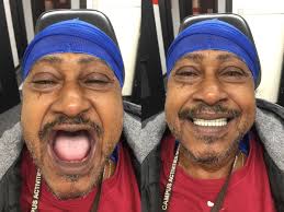 For Patients — D-DENT