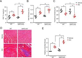 Nine men who were indicted and seven hanged for the murders. Sirt2 Deacetylase Represses Nfat Transcription Factor To Maintain Cardiac Homeostasis Journal Of Biological Chemistry