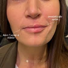 Rejuvenate Skincare and Laser