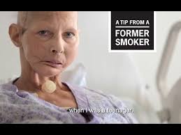 CDC: Tips From Former Smokers