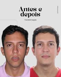 Bucomaxilo em Salvador