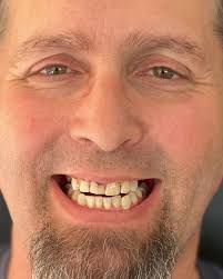 Advanced Dental Implant Center of Denver