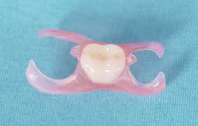 Dental Flippers A Perfect Solution To Missing Teeth During Implant Treatments European Denture Center