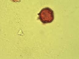 Image result for Uapaca guineensis