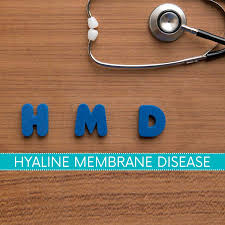 Hyaline Membrane Disease Causes Symptoms And Treatment