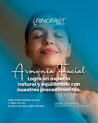 Paciente Mariela Quintero con Rinoplastia,sin cicatriz visible con  Anestesia Local. (Cirugía funcional y Estética, Rápida recuperación)  Técnica creada por el (Dr. Hector Manuel Marin Mendez ) Contáctanos Tel:  (667) 7151142