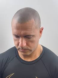 Bring back your confidence with SCALP MICROPIGMENTATION 💉 Instant, natural  & long-lasting results... A quick, effective solution ! NO surgery & NO  complicated maintenance... Choose your look: Natural hairline Modern