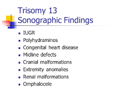 In my clinical experience of 31 years practicing neonatal medicine, i would have to answer your question with a vague response. Obstetrical Ultrasound Ppt Download