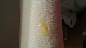 Yellow Cm Tmi Picture Trying To Conceive Forums What To Expect