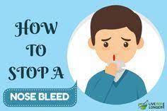 Onions Can Stop Nosebleed Check This Out For Simple Home Remedies Nose Bleed How To Stop A Nose Bleed Stop Nose Bleeds