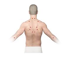 Image result for Trigger Point Location