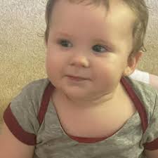 When will Dexcom deliveries return to normal?