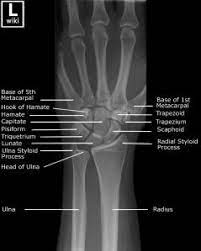 wrist radiographic anatomy medical radiography radiology student anatomy