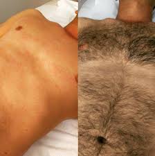 Sure, hair removal can be tricky—especially if it's a part of your body that's hard to reach—but the wax specialists at ewc totally have your back. Man Wax Waxing For Men And Women Male Waxing Brazilian Waxing Manzilian Waxing Parramatta