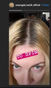 ••• μπορεί εσύ να απολαμβάνεις το καλοκαίρι, για τα μαλλιά σου όμως δεν είναι ότι καλύτερο. Smaragda Karydh Ebale Ton A8eridh Na Ths Bapsei Ta Mallia In Gr