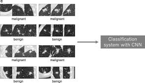 Cnn/u.s is an america based international news station owned by turner broadcasting. Convolutional Neural Networks An Overview And Application In Radiology Insights Into Imaging Full Text