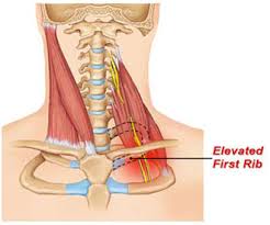 Grab a dumbbell and position yourself so you're perpendicular to the seat. Chronic Neck Shoulder Pain Cascade Chiropractic Wellness