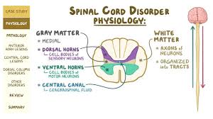 Many present with serious acute symptoms such as paresthesia, paralysis, and loss of sensation or bladder and bowel function. Spinal Cord Disorders Pathology Review Osmosis
