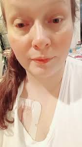 Baxter North Cove Nc Chroinc Illnses