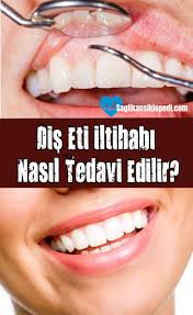 Dis Eti Iltihabi Nasil Tedavi Edilir Agizsagligi Dissagligi Agizdissagligi Disetitedavisi Disetihastaliklari Disetleri Diseti Disetitedavisi Disetleri