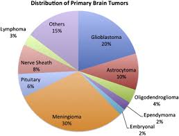 brain tumor diagram technical diagrams