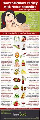 How To Remove Hickey Fast With Home Remedies Home Remedies Remedies How To Remove