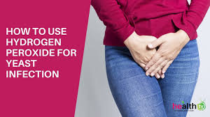 However, it is necessary to understand that hydrogen peroxide cannot be recommended as a standalone treatment for yeast infection. 4 Easy Ways To Use Hydrogen Peroxide For Yeast Infection Youtube