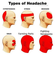 Headache Location Diagram Headache Location Chart Causes