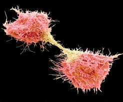 Find out more about types of cancer cancer is a disease that occurs when malignant cells grow in the body. Close Up Views Of Tumors Reveal A New Cancer Biology Scientific American