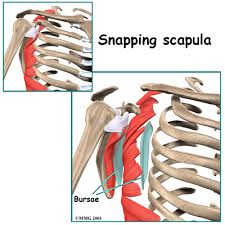 Image result for Scapulothoracic Injection