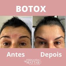 𝙁𝙚𝙧𝙣𝙖𝙣𝙙𝙖 𝙈𝙖𝙩𝙩𝙖𝙧 𝘿𝙚 𝙇𝙖́ 𝙎𝙖́𝙫𝙞𝙖  (@dra.fernandamattardelasavia) • Instagram photos and videos