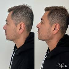 Johnson, Shawn, Evette, MD, 3720 Westheimer Rd, Ste 601, Houston, TX 77027,  US