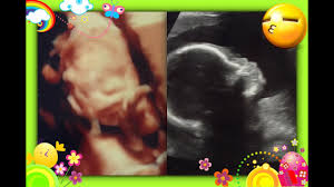 Y se mueve muchisimo ^_^.es varon! Feto De 22 Semanas Quanto Pesa Firearm Semanas De Gestacion