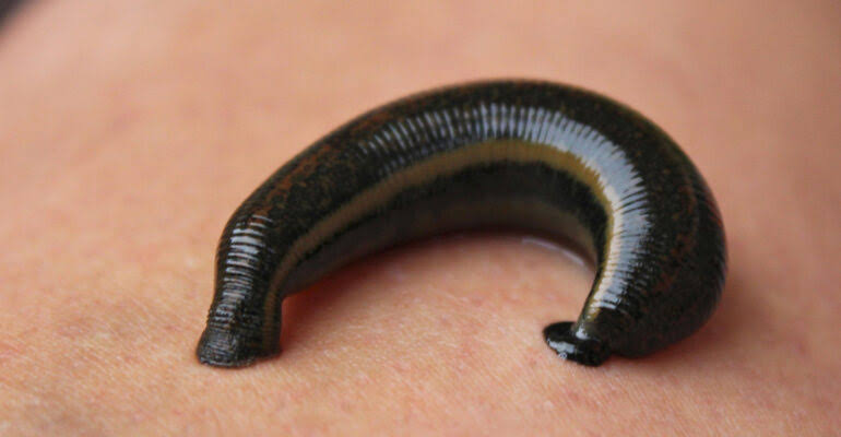 LEECH THERAPY product image