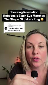 Peter Brabeck Letmathe Black Eye