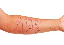 Image result for Allergy Screening