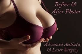 Check spelling or type a new query. Change In Bra Size Following Breast Surgery Columbus Oh