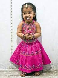 Jyoti nació con una extraña enfermedad llamada acondroplasia, la cual es la causa de su enanismo, la estatura que posee actualmente es la que tendrá. Jyoti Amge Estatura Altura Peso Medidas Edad Biografia Wiki