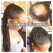 14 Extraordinary Alopecia Camouflage Cornrows By Braids By Necole Braids For Thin Hair Braids For Black Hair Alopecia Hairstyles