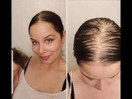 Little Diy Youtube Hairstyles For Thin Hair Hair Loss Hair Beauty