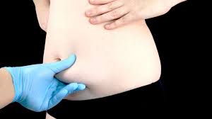 Image result for Umbilicus