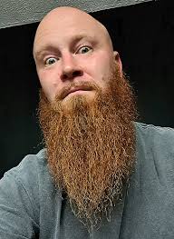 Santo's gotee beard before surgery