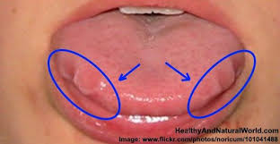 If You Have These Marks On Your Tongue See Your Doctor Now Tongue Health Healthy Tongue Tongue Inflammation